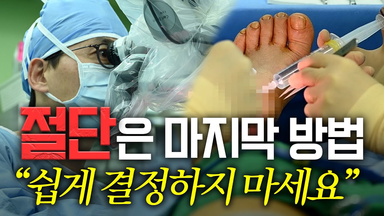 하지 재건 미세수술의 명의가 말하는 '걸어서 병원 나가는 법'